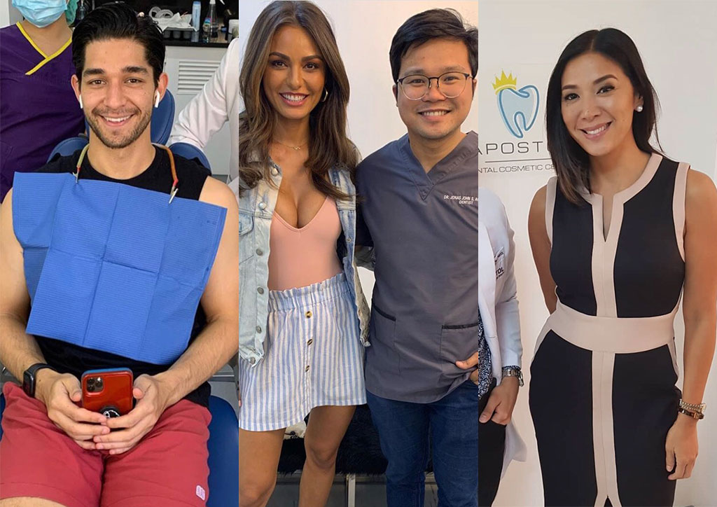 apostol dental, wil dasovich, veneers