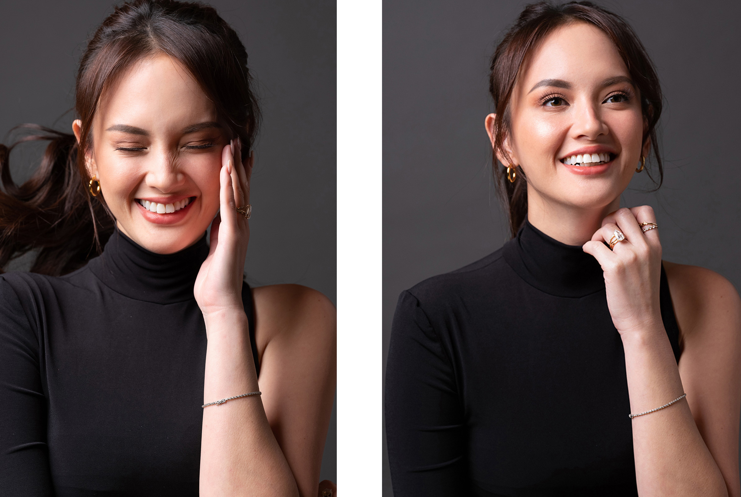 Ellen Adarna joins the Merz Aesthetics family as the face of Ultherapy