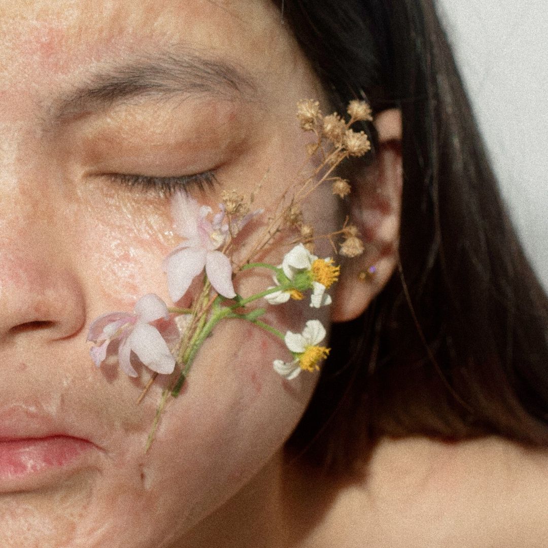 Larra Lasam Burn Survivor Beauty