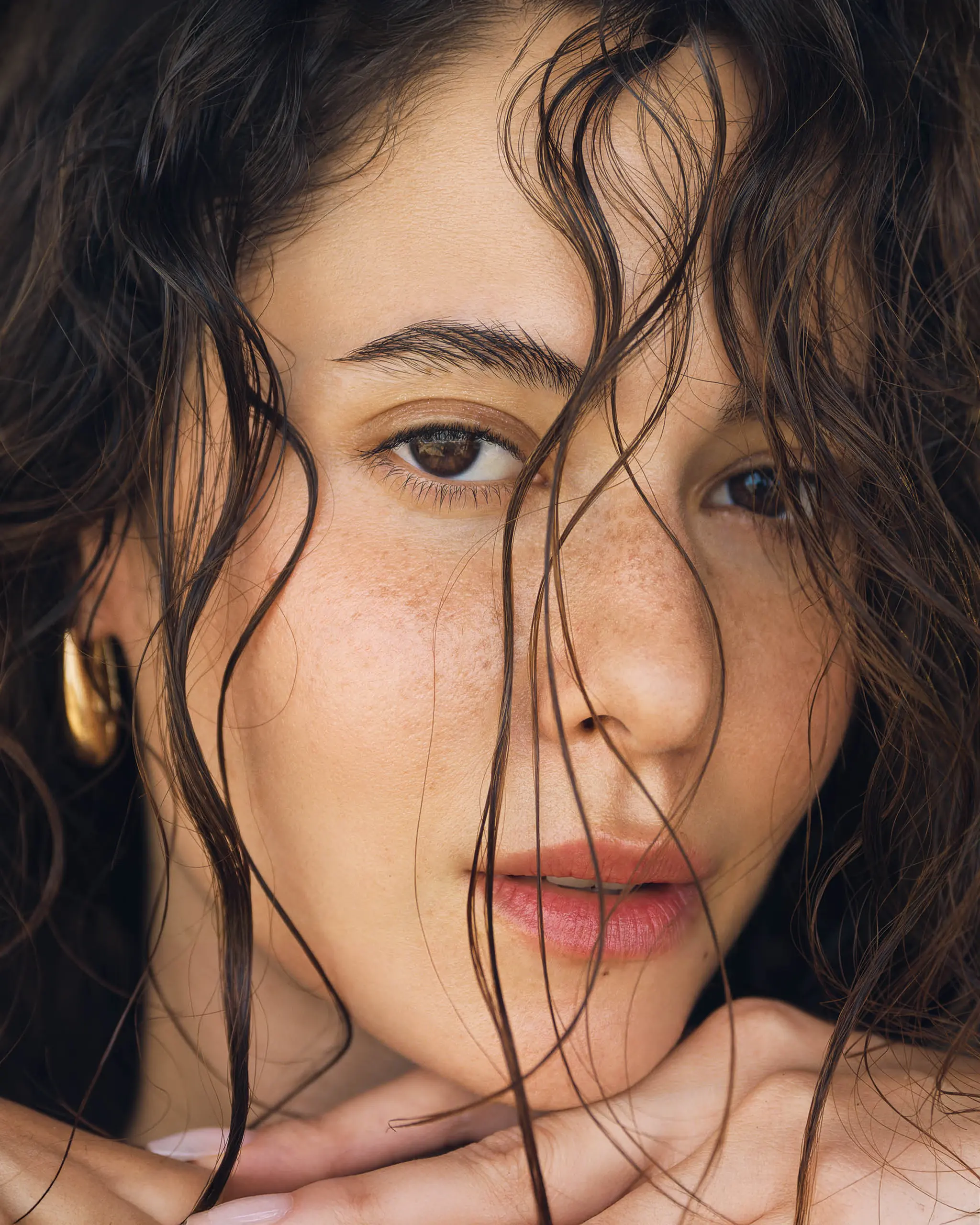 No One in This Island Gets Acne—Here’s What We Can Learn From Them