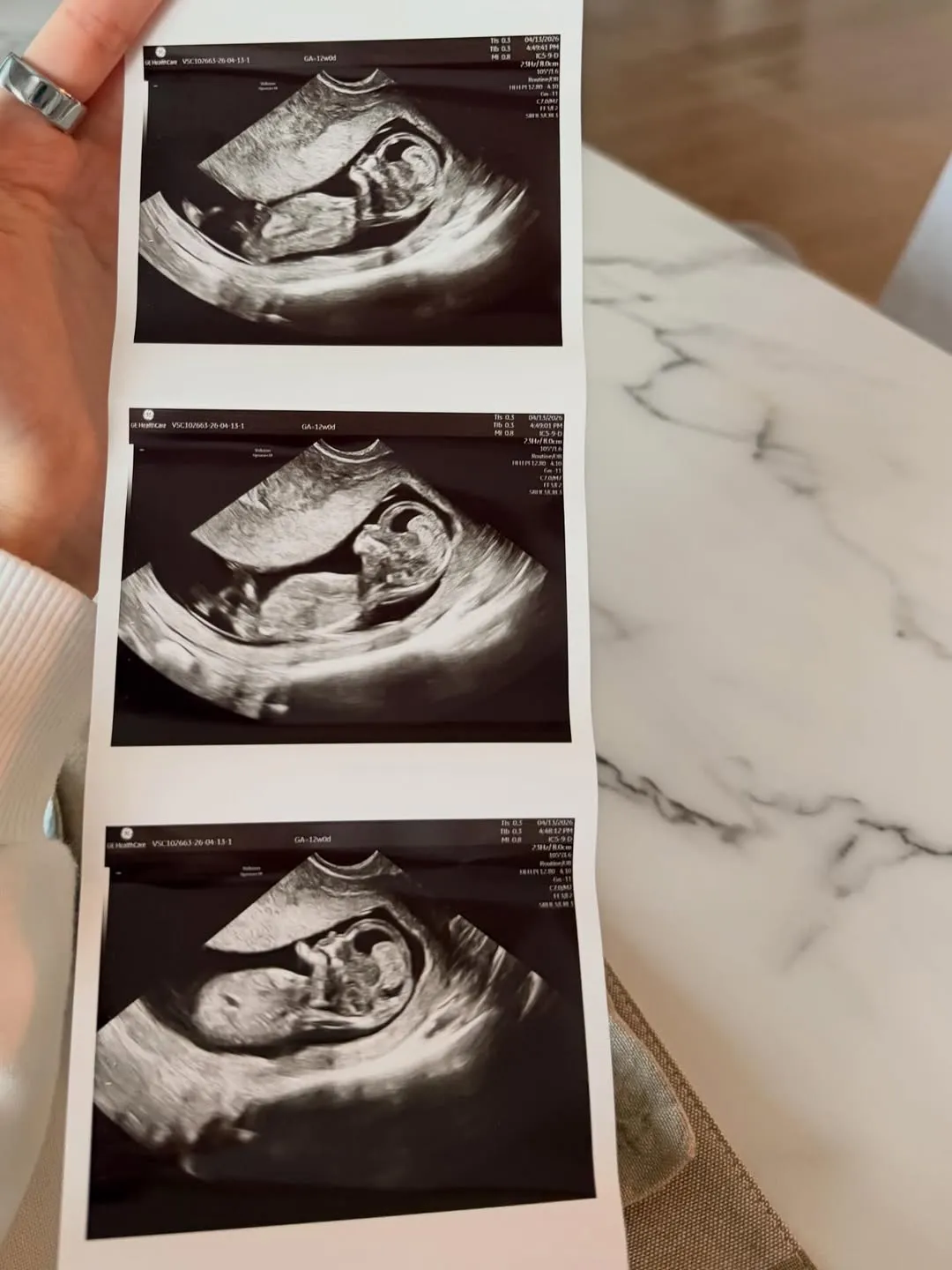 Celeste Cortesi Baby Boy Ultrasound